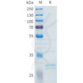 Human FGF2 Protein, Flag Tag – Figure 1 of 1