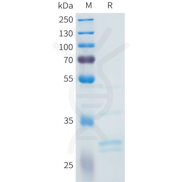 Human FGF2 Protein, Flag Tag – Figure 1 of 1