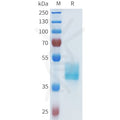 Human ASGR1(61-160) Protein, hFc Tag – Figure 1 of 1