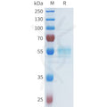 Human ASGR1(124-291) Protein, hFc Tag – Figure 1 of 1