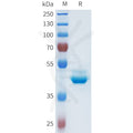 Human CDH1(155-262) Protein, hFc Tag – Figure 1 of 1