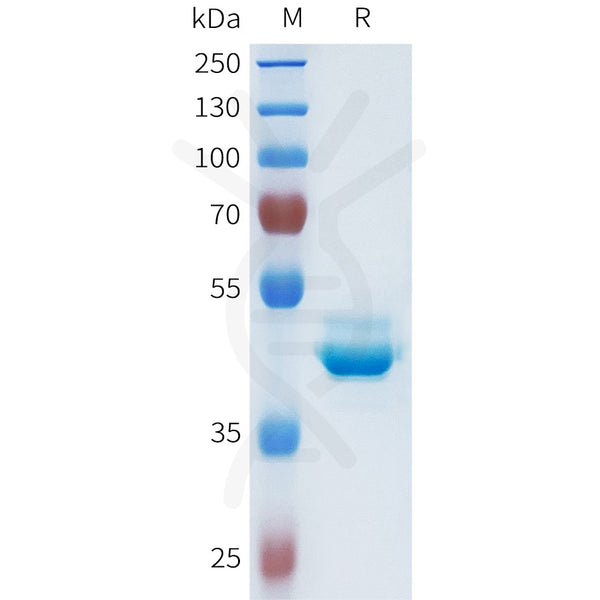 Human CDH1(155-262) Protein, hFc Tag – Figure 1 of 1