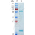 Human GDF2 Protein, Flag Tag – Figure 1 of 1