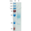 Human CDH6(384-486) Protein, hFc Tag – Figure 1 of 1