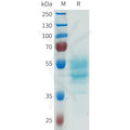Human CDH6(487-615) Protein, hFc Tag – Figure 1 of 1