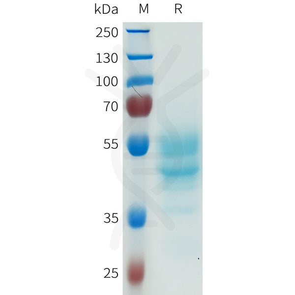 Human CDH6(487-615) Protein, hFc Tag – Figure 1 of 1