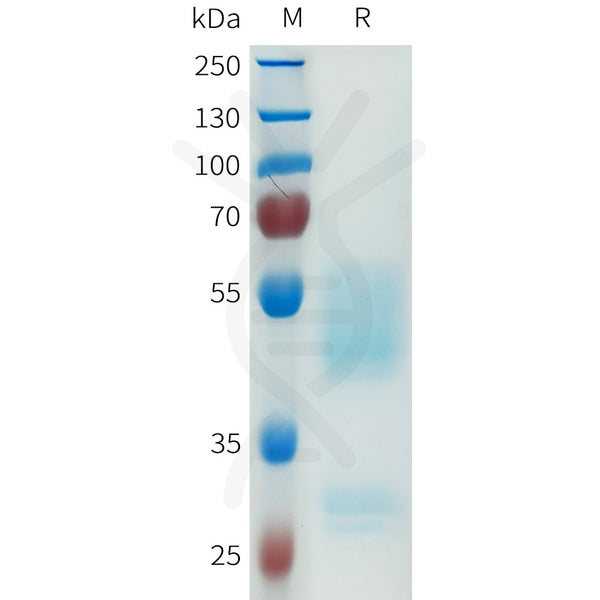 Human PRLHR Protein, hFc Tag – Figure 1 of 1