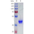 Biotinylated Human BCMA Protein, hFc Avi Tag – Figure 1 of 1