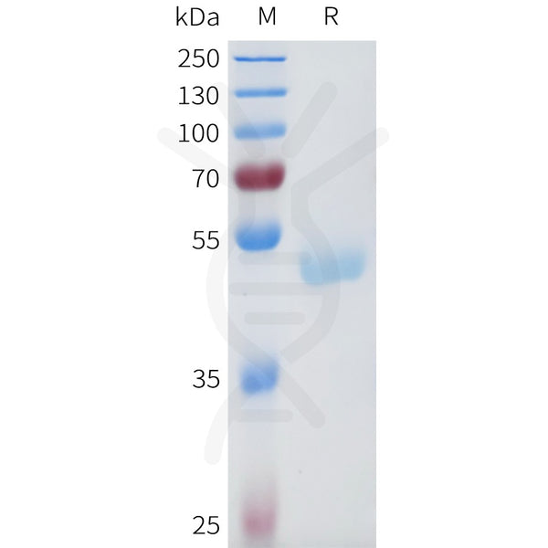 Human CTSD Protein, His Tag – Figure 1 of 1