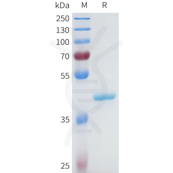 Human CTSL Protein, His Tag – Figure 1 of 1