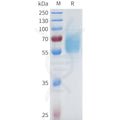 Human EGFR(301-645) Protein, His Tag – Figure 1 of 1