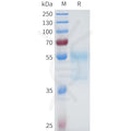 Human 5T4(32-91) Protein, hFc Tag – Figure 1 of 1