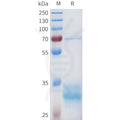 Human 5T4(92-115) Protein, hFc Tag – Figure 1 of 1