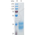 Human 5T4(114-140) Protein, hFc Tag – Figure 1 of 1