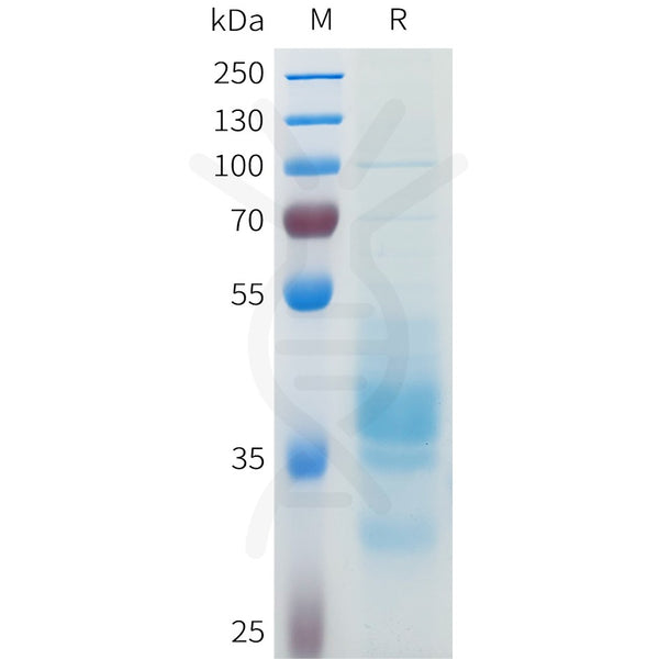 Human 5T4(164-208) Protein, hFc Tag – Figure 1 of 1