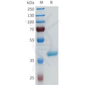 Human ENPP3(94-159) Protein, hFc Tag – Figure 1 of 1
