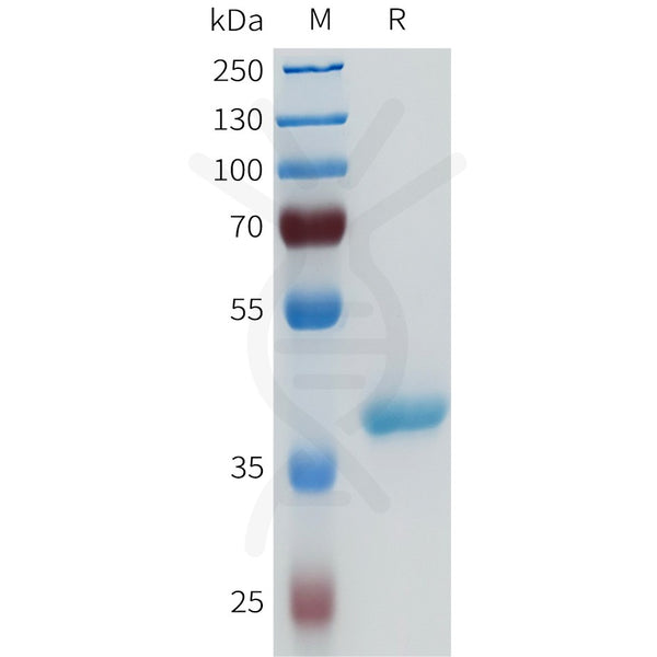 Human ENPP3(94-159) Protein, hFc Tag – Figure 1 of 1