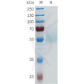 Human ENPP3(546-875) Protein, His Tag – Figure 1 of 1
