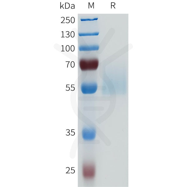 Human ENPP3(546-875) Protein, His Tag – Figure 1 of 1