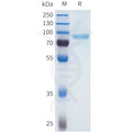 Human SEMA4A Protein, His Tag – Figure 1 of 1