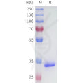 Human CA9(138-414) Protein, His Tag – Figure 1 of 1