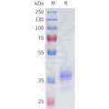 Human 5T4(233-255) Protein, hFc Tag – Figure 1 of 1
