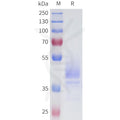 Human 5T4(256-355) Protein, hFc Tag – Figure 1 of 1