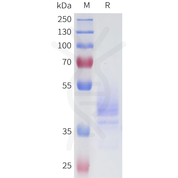 Human 5T4(256-355) Protein, hFc Tag – Figure 1 of 1