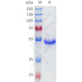 Human CA9(38-137) Protein, hFc Tag – Figure 1 of 1