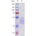 Human ACVR2B(36-105) Protein, mFc Tag – Figure 1 of 1
