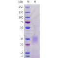 Human ACVR2A(20-135) Protein, His Tag – Figure 1 of 1
