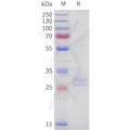 Human TNFSF15 MTQ Protein, His Tag – Figure 1 of 1