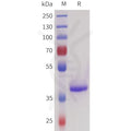 Human SEZ6(355-415) Protein, hFc Tag – Figure 1 of 1