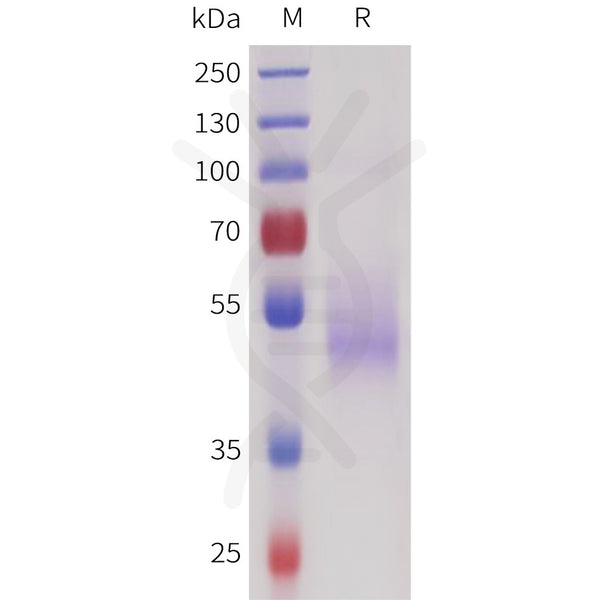 Human SEZ6(415-529) Protein, hFc Tag – Figure 1 of 1
