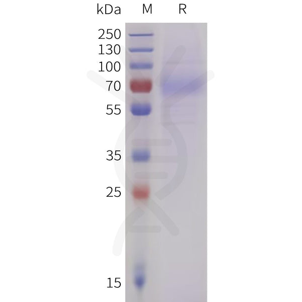 Human LILRA4 Protein, N-His Tag – Figure 1 of 1