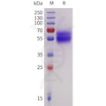 Human IL18RA Protein, His Tag – Figure 1 of 1