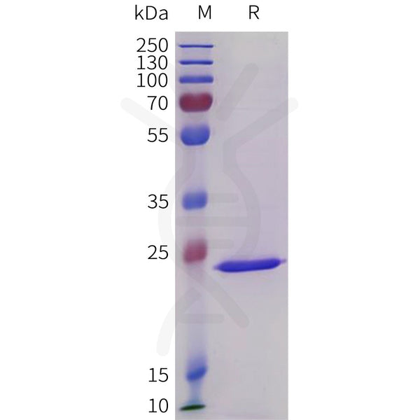 Human CRP Protein, His Tag – Figure 1 of 1