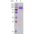 Human PECAM1 Protein, His Tag – Figure 1 of 1