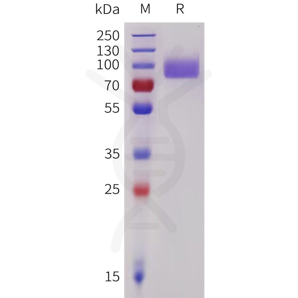 Human PECAM1 Protein, His Tag – Figure 1 of 1