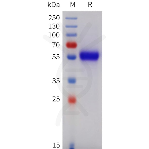 Human TNFRSF11B Protein, His Tag – Figure 1 of 1