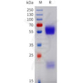 Human GGT1 Protein, His Tag – Figure 1 of 1