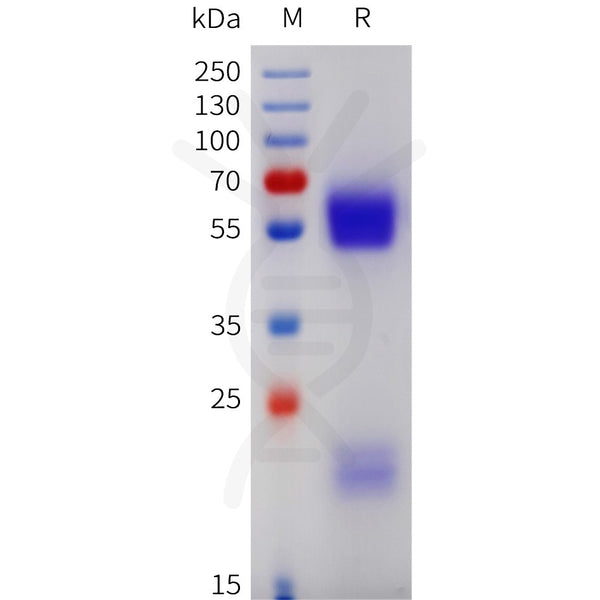 Human GGT1 Protein, His Tag – Figure 1 of 1