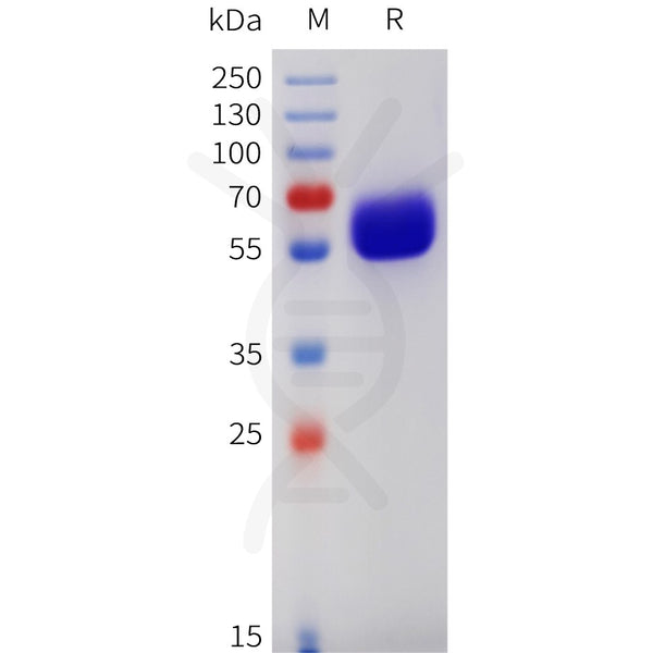 Human CSF2RB Protein, His Tag – Figure 1 of 1