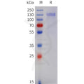 Human COMP Protein, His Tag – Figure 1 of 1