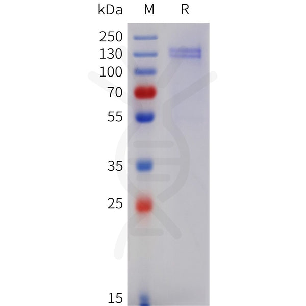Human COMP Protein, His Tag – Figure 1 of 1
