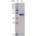 Human SECTM1 Protein, hFc Tag – Figure 1 of 1
