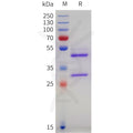 Human VEGFC Protein, hFc Tag – Figure 1 of 1