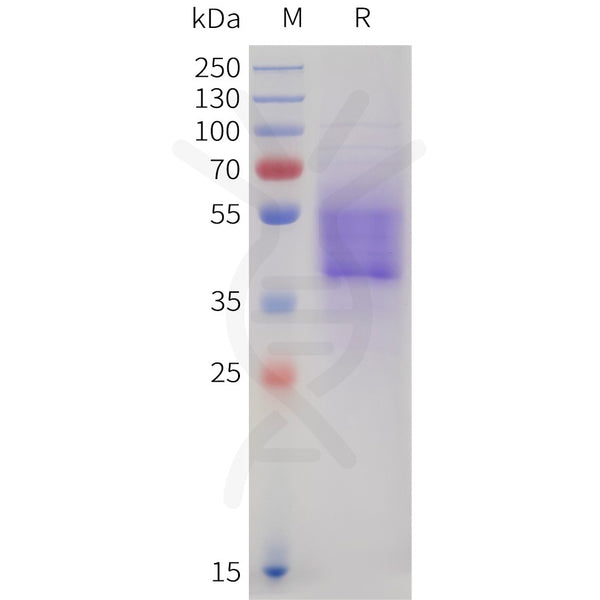 Human CB1(1-116) Protein, mFc Tag – Figure 1 of 1