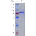 Human F11 Protein, Flag Tag – Figure 1 of 1