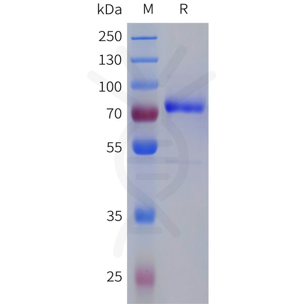 Human F11 Protein, Flag Tag – Figure 1 of 1